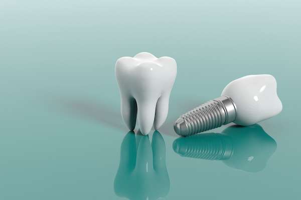 Tips For Managing Multiple Dental Appointments For The Whole Family